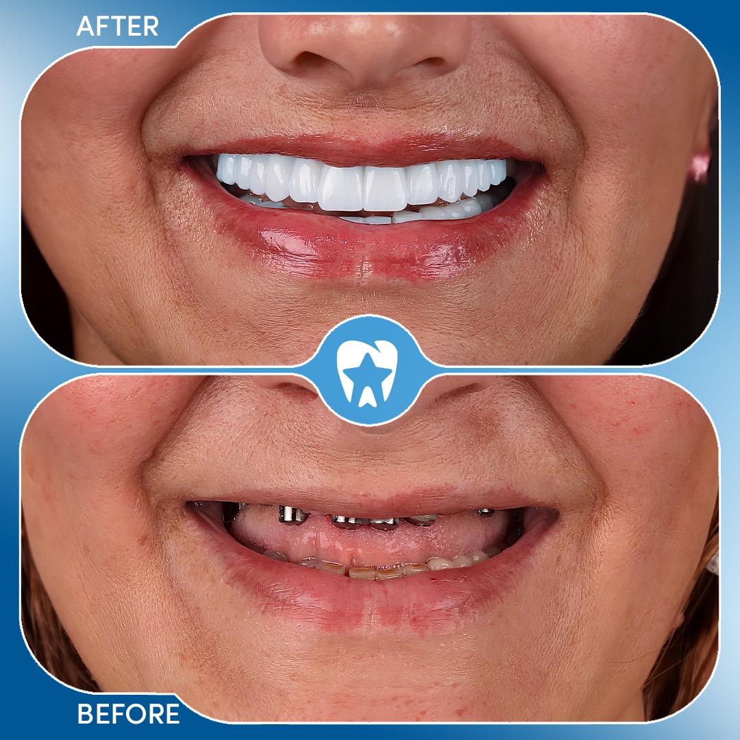 Before and after dental treatment