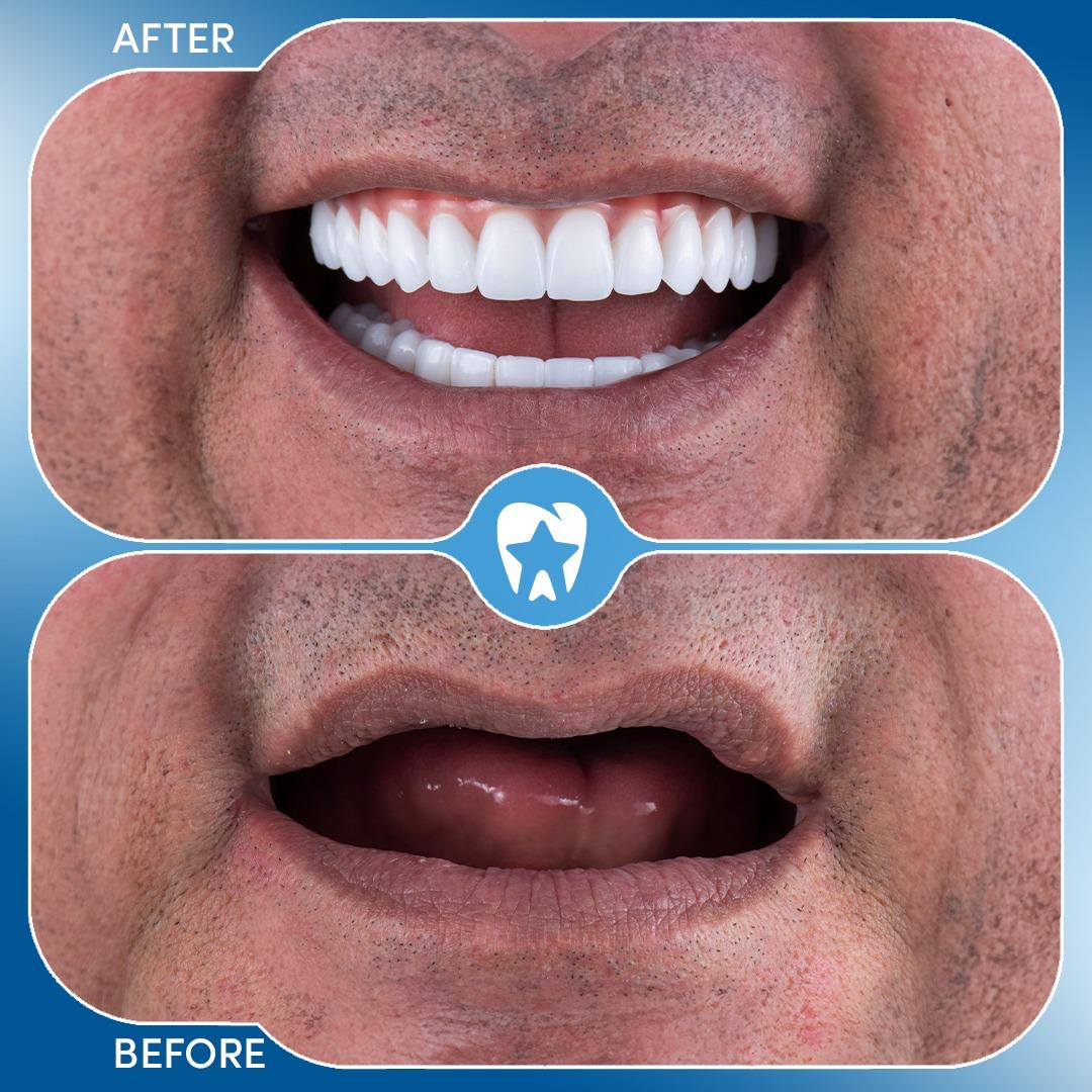 Before and after dental treatment